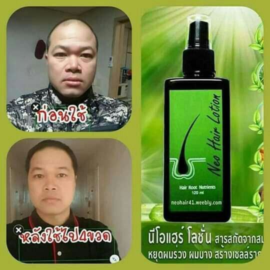 How To Use Neo Hair Oil at Ursula Stevenson blog