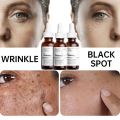 The Ordinary Retinol Serum Retinol 0.2% in Squalane - Retinol 1% In Squalane - Retinol 0.5% in Squalane Retinoid Serum - 30ml. 