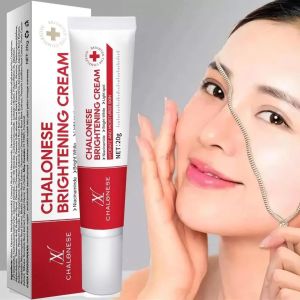 Whitening Blemish Freckle Cream Whitening Blemish chalonese - Krim Penghilang Flek Wajah - Cream Glowing Salep Flek 20gr