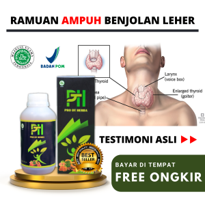 Obat Kelenjar Tiroid Di Leher Tumor Ganas Dan Jinak Penyakit Getah Bening Herbal Benjolan Lipoma yg Ampuh Uci Uci Gondok Beracun Kanker Stadium Lanjut Pro DT Herba 100% Original Paling Ampuh