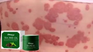 South Moon Tea Tree Oil Skin Care Cream Gentle Cleansing Special Nourishing Skin Moisturizing Care Cream