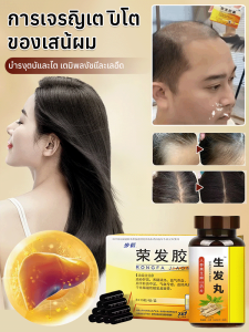 ปกป้องตับอย่างไร้กังวลและอาหารเสริมบํารุงผม ตัวอย่างโสมและยาสมุนไพรจีน เสริมหลังการขาย/สารเติมแต่งการดูแลเส้นผมตับ ซันโชหลังการขายยาจีน