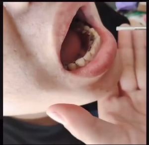 🔥 Lựa Chọn Chất Lượng 🔥✨ Nổi Bật ✨ Dụng Cụ Đánh Bóng tooth grinder tooth grinding artifactTooth grinding machine polishing calculus removing dental scali