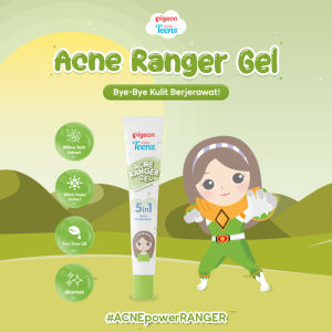 𝗝𝗨𝗡𝗞𝗜𝗘 𝗠𝗔𝗞𝗘𝗨𝗣 -Pigeon Teens Acne Ranger Gel 15ml