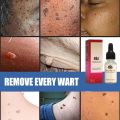 Skin Tag Remover Penghilang Kutil Tanpa Luka Serum Perbaikan Flek Hitam Memudarkan Flek Memutihkan Tanpa Bekas 20ml. 
