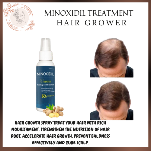 Minoxidil Hair Grower Beard And Hair Growth Spray Minoxidil spray ...