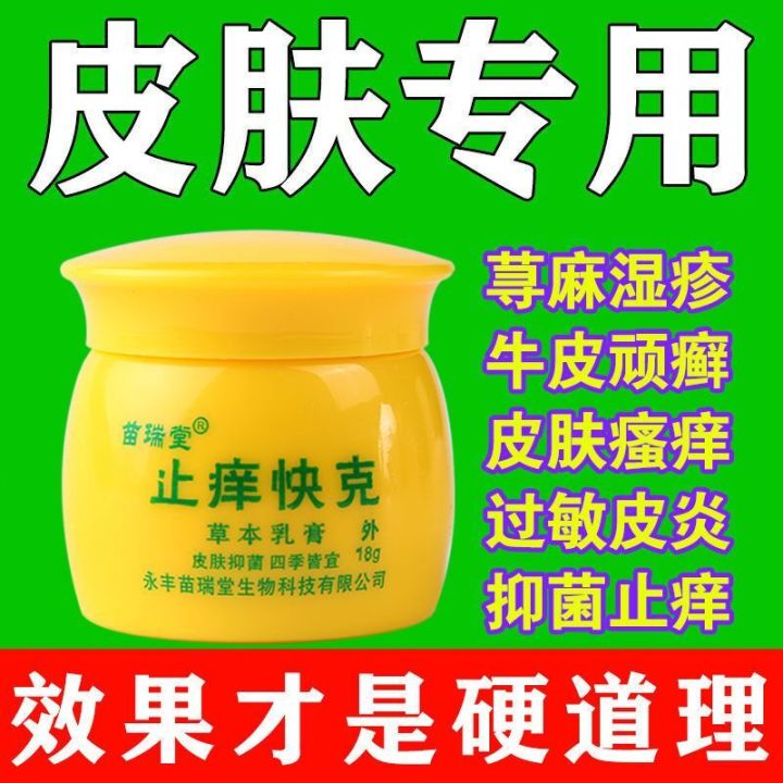 #精选#止痒快克Eczema cream急慢性荨麻疹膏风团止痒膏过敏瘙痒皮肤病湿疹膏 止痒快灵dayuan | Lazada