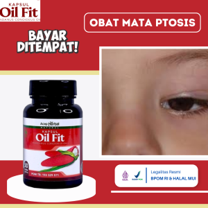 Obat Mata Ptosis Obat Kelopak Mata Turun Sebelah Obat Mata Beda Sebelah Obat Penyakit Mata Ptosis Obat Kelopak Mata Kendur Obat Saraf Mata Rusak Obat Penurunan Kelopak Mata Dengan Oil Fit