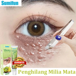 Kem Mắt Vitamin E Thiên Nhiên Đặc Biệt Cho Mắt Nhiều Mụn Thịt - Lành Tính Không Kích Ứng An Toàn Tuyệt Đối