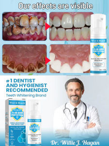 Mousse Foam Toothpaste White Mouth Odor Cleaning Sta White Teeth Mousse Foam Toothpaste