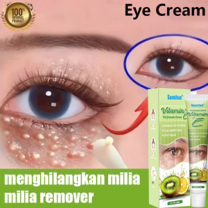 Milia Remover Eye cream for dark circles Anti aging wrinkles eyebags remover Fight Puffiness Treatment Care