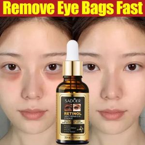 Serum Mata Retinol Krim Mata Mengangkat Mengencangkan Anti Penuaan Menghilangkan Keriput Lingkaran Hitam / Retinol Eye Serum Dark Circles and Eyebag Remover Original Anti Aging Lifting EyeCare Essence 30ml