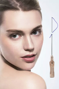 UVERLA  PDO/PCL  mono screw thread for Face/Body Lifting  PDO/PCL Thread  High quality   26g 60mm  20pcs