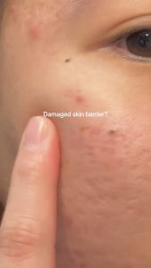 Tinh chất giảm mụn phục hồi da AXIS-Y ARTICHOKE INTENSIVE SKIN BARRIER AMPOULE