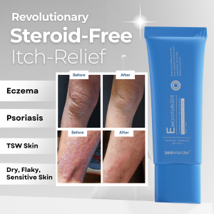 E1 Eczema Moisturizer