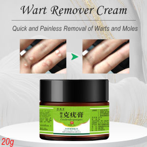 Mole remover Genital warts Remove cream Painless Rapidly removes moles Antibacterial Foot Warts Hand Warts Corn Skin Tag Warts RemoverGenital warts Remove cream Painless Rapidly removes moles.