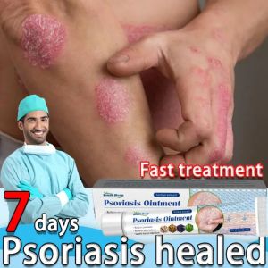 [Chính Hãng South Moon] Kem bôi vẩy nến viêm da kháng khuẩn đánh bay nấm da chống ngứa viêm da hắc lào lang ben mề đay viêm da cơ địa á sừng vảy nến tổ đỉa viêm da dị ứng