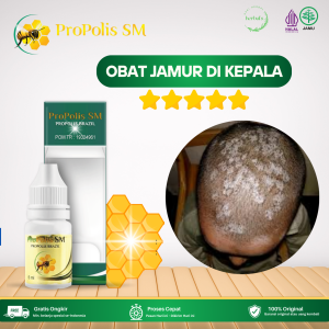 Obat Jamur Di Kepala Obat Untuk Jamur Di Kepala Obat Infeksi Jamur Di Kepala Obat Kurap Obat Herpes Tonsil Obat Infeksi Jamur Kulit Obat Kulit Kepala Bersisik / Berkerak Obat Tinea Kapitis Dengan Propolis SM