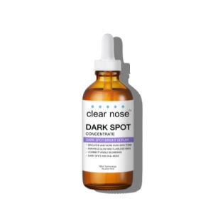 CLEAR NOSE Dark Spot Bright Serum 100ml |Strengthen Skin BarrierSmooth Rough Texture | Target Freckles Melasma & Post-Inflammatory Hyperpigmentation