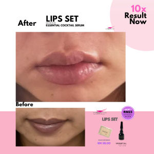 Set Lips - Untuk Penjagaan/Merawat masalah Bibir yang Kusam