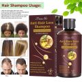 Hair Growth Shampoo - Anti-Thinning, Thickening Shampoo for Hair Loss & Grow Hair Fast for Men & Women, 220ML. 