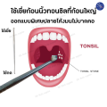 ส่งไว อุปกรณ์กำจัดนิ่วทอนซิล นิ่วทอมซิน สาเหตุกลิ่นปากเหม็นนิ่วทอลซิน ไซริ้งฉีดฟันคุด ลดกลิ่นปาก กลิ่นปากแรง ไซริ้งปลายโค้ง tonsil stone ไซริ้ง. 