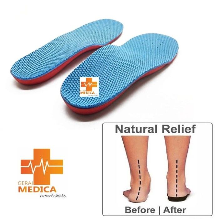 Fisioterapi Apa Itu Flat Foot Insole Flat Foot Insole Kaki Bebek