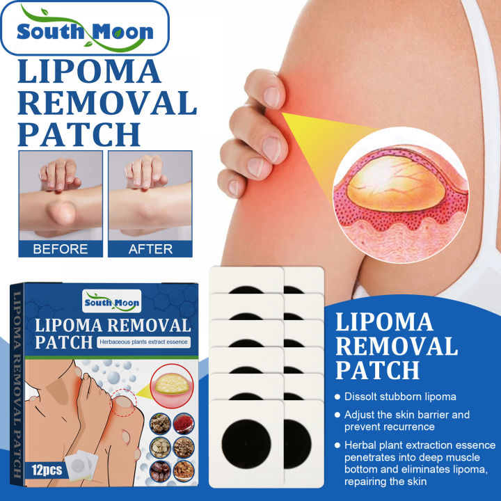 South Moon Lipoma Removal Patches Effectively Lipolysis Fat Lump ...