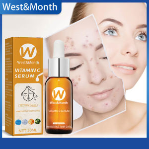 Tháng Tây Vitamin C Huyết Thanh Tinh Chất chăm sóc da mặt Fade mụn trứng cá trên mặt Kiểm Soát Dầu làm săn chắc da Giảm Đỏ Và nhược điểm Giữ Da Mềm Mại Và Đàn Hồi Cải Thiện Hàng Rào Bảo Vệ Làm da mặt Khỏe Mạnh Sản Phẩm Dưỡng Da