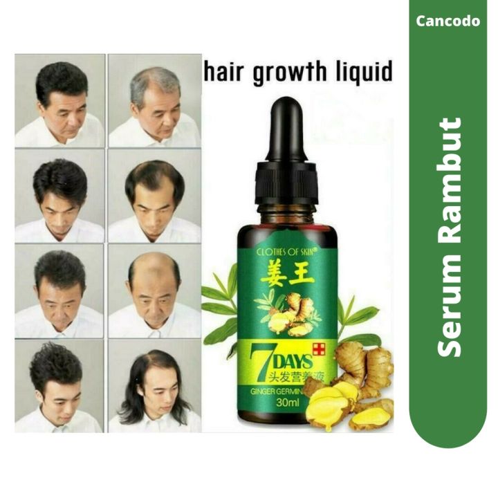 7 Days Clothes Of Skin Minyak Penumbuh Rambut Ginger Germinal Oil