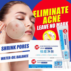 30g Anti-Acne Cream Acne Treatment Gel Pimple Scars Remover Skin Care Repair Comedone Pimple
