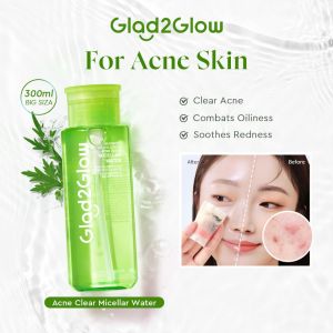 Glad2Glow Mugwort Salicylic Acid Acne Clear Micellar Water 300ml Deep Clean Waterproof Makeup Control Excess Oil Soothe Facial Redness Purify Pores Gentle Oil Acne Skin Daily Cleansing Makeup Remover