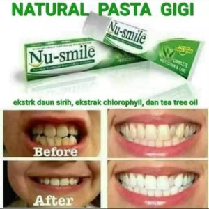 NU SMILE Toothpasta nafas lebih segar sepanjang hari