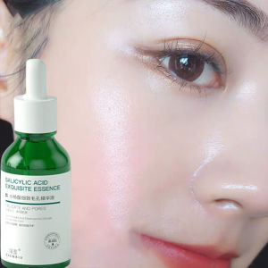Salicylic Acid serum Pore Shrinking Essence Brightening Niacinamide serum muka Clean Pore whitening Skin Replenishes Skin Moisture Shrink Pore blackhead removal