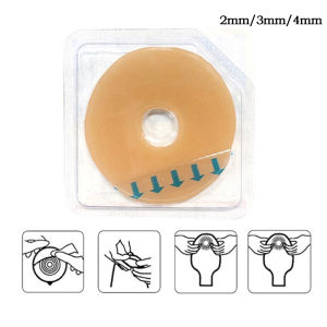 1Pc ostomy paste baseplates stoma ดูแลวงแหวนป้องกันการรั่ว 2/3/4mm