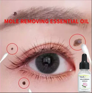 7 days Removes mole Rose Essential oil 20ml Lighten melanin remove moles skin care light spots spot removal freckle Brighten skin colour Vitamin e Serum