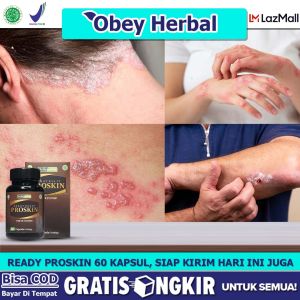 Obat cacar Air / Dermatitis / Kudis/ Kurap / Herpes / Biduran / ALergi CUaca / Makanan / Vitiligo / Ruam Merah / Kulit Gatal Gatal / Jerawat / Bisul/ Keloid / Proskin kapsul Atasi Berbagai Macam Penyakit Kulit Lainya