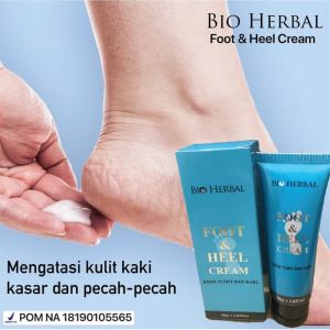 Obat Kaki Pecah2 dan Kering Parah BPOM Mabrem krim Salep Rorombeheun Gatal Cream Tumit Kapalan