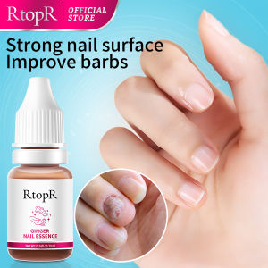 RtopR Ginger Antibacterial Nail Treatment Essential Anti Fungal Infection Toe Nursing Anti Infection Paronychia Onychomycosis 10ml