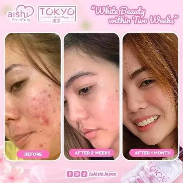 how long will glutathione injection take effect how long does a glutathione shot last Glutathione Injections For Skin  Whitening: Benefits, Uses, Side Effects
