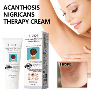 EELHOE Body Brightening Cream 60g - Fades Dark Spots on Neck Knees Elbows & Underarms Moisturizing Skin Tone Even Care