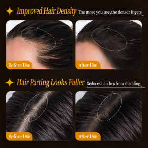 Anti Hair Loss Serum Ginger Hair Growth Essence Natural Scalp Treatment Herbal Hair Serum