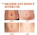 Vova Strechmark cream krim penghilang stretchmark stretchmark selulit. 