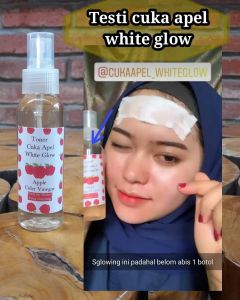 Terlaris Toner cuka apel white glow/ Toner Terlaris mengglowingkan dan membasmi jerawat pada wajah