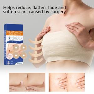 Xóa sẹo Sheets đối với vú thoáng khí sẹo Tape Silicone sẹo Sheets Breast bài Nguồn cung cấp
