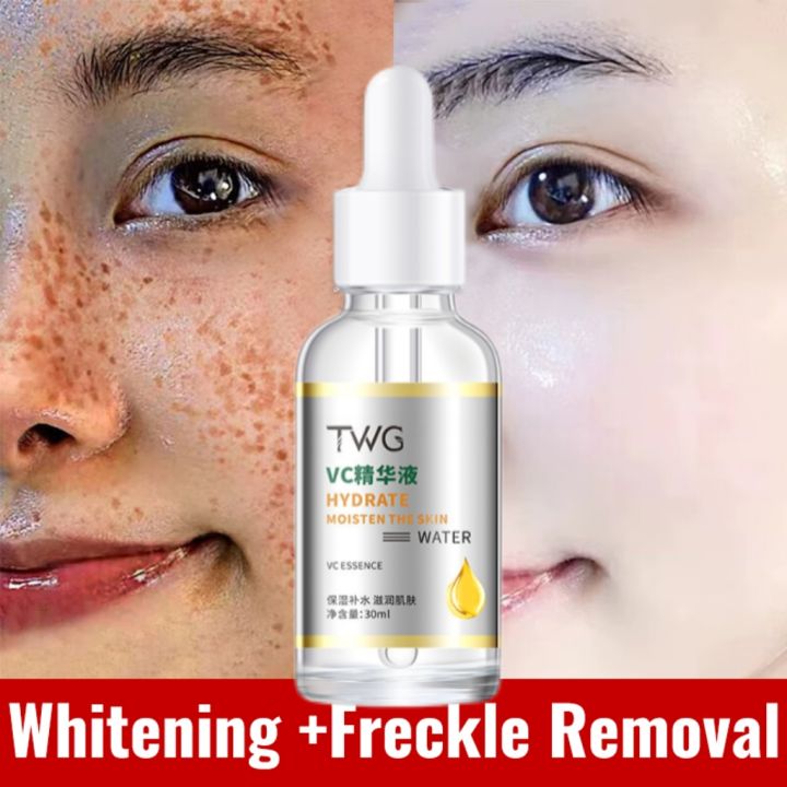 100 Original Vitamin C Serum Melasma serum For Face Whitening Dark