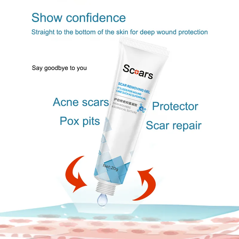 Scar Removal Gel Scar Repair Cream Stretch Mark Removal Cream Fade Burn  Scars Burns Acne Marks Waterproof Maternity 20g | Lazada
