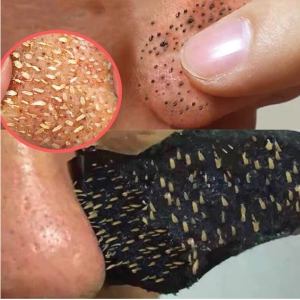 LELNIA ลอกสิวเสี้ยน มาส์กหน้า เเผ่นลอกสิวเสี้ยน สิวเสี้ยน มาส์กลอกสิว  ชาโคล มาส์กจมูก แผ่นลอกสิว สิวหัวดำ