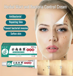 Herbal Wart Removal Antibacterial Cream Antifungal Itch Relief  Natural Dark Spot Soothing Cream
