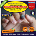 Obat Buat Melanoma Kuku Kaki, Obat Kanser Melanoma Kuku, Obat Melanoma Di Kuku, Obat Melanoma Di Kuku Di Apotik, Obat Kuku Hitam Karena Melanoma, Obat Tradisional Untuk Melanoma Di Kuku, PROPOLIS SM 100% ORIGINAL. 